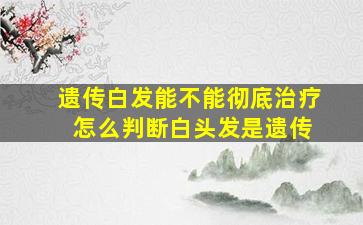 遗传白发能不能彻底治疗 怎么判断白头发是遗传
